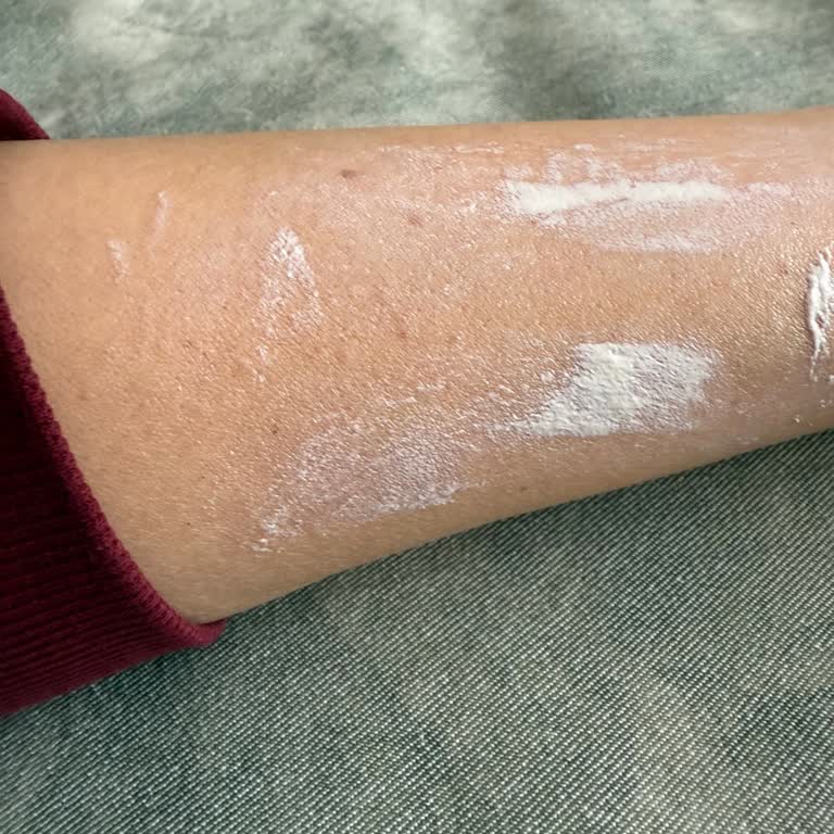 Görkito Güneş Kremi Süre Dolmadan Bozuldu, Müşteri Hizmeti İlgisiz