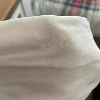 Küflü Islak Mendil Skandalı: Bebeğimin Sağlığı Tehlikede!