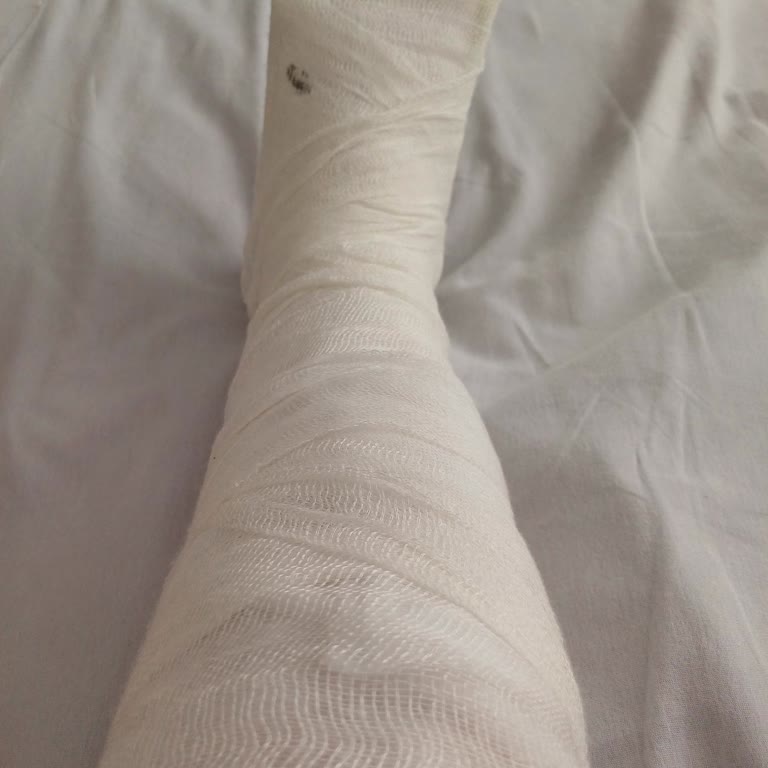 BİM Market Önündeki Açık Mazgal Nedeniyle Yaralandım, Çalışanlar İlgisizdi