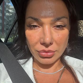 Dr. Levent Ateş Burun Ameliyatı Pişmanlığı