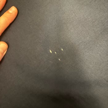 Satın Aldığım Üründe Açılma Oldu, İade Talebim Var