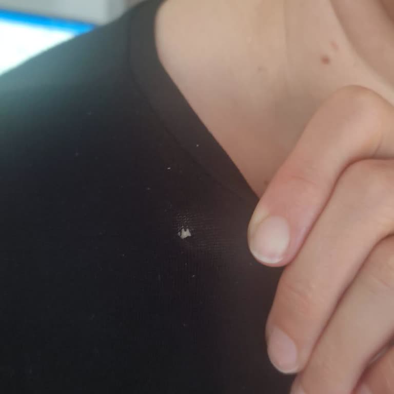 İlk Giyimde Fark Edilen Defolu Üründe Değişim Ve İade Sorunu