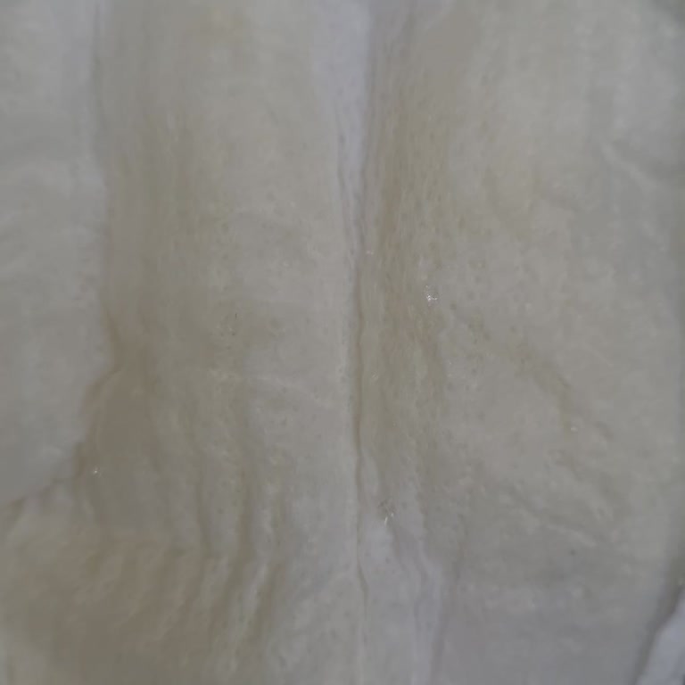 Molfix Bebek Bezinde Şeker Benzeri Yabancı Maddeyle Karşılaştım, Endişeliyim