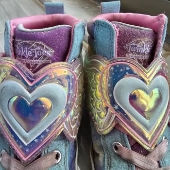 Skechers Ayakkabı Kısa Sürede Bozuldu, SuperStep Müşteri Hizmetleri Dönüş Yapmıyor