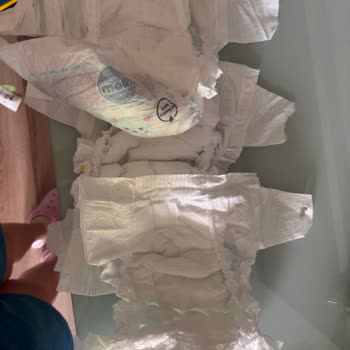 Molfix 4 Numara Bezlerde Yapıştırma Kısmı Kopuyor, Bezler Kullanılamıyor