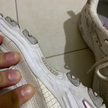 Skechers Ayakkabımın Kenarları Kısa Sürede Açıldı