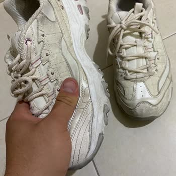Skechers Ayakkabımın Kenarları Kısa Sürede Açıldı