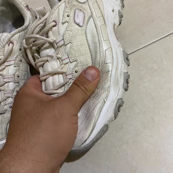 Skechers Ayakkabımın Kenarları Kısa Sürede Açıldı