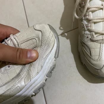 Skechers Ayakkabımın Kenarları Kısa Sürede Açıldı