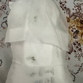 Ebebek'ten Aldığım Sleepy Newborn Islak Mendil Küflü Ve Son Kullanma Tarihi Geçmiş Çıktı