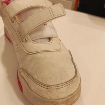Adidas Ayakkabının Kısa Sürede Deforme Olması Ve Olumsuz İnceleme Sonucu