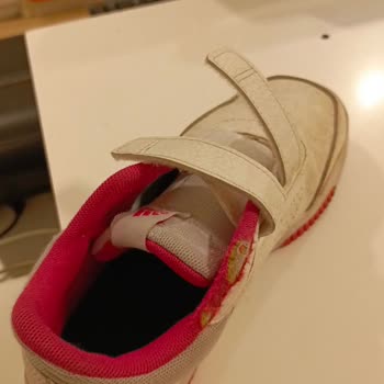 Adidas Ayakkabının Kısa Sürede Deforme Olması Ve Olumsuz İnceleme Sonucu
