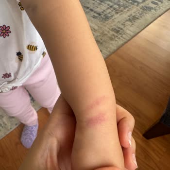 Çocuğumun Kan Alımında Yaşanan İhmaller Ve Mağduriyet