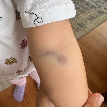 Çocuğumun Kan Alımında Yaşanan İhmaller Ve Mağduriyet