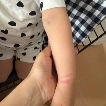 Çocuğumun Kan Alımında Yaşanan İhmaller Ve Mağduriyet