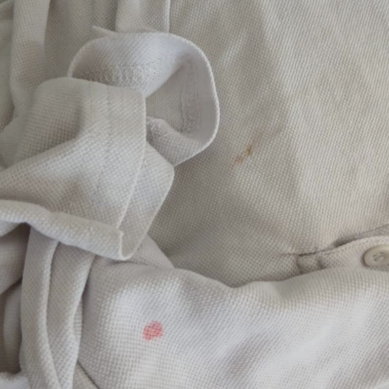 Beko Çamaşır Makinesi Ve Servisten Hayal Kırıklığı