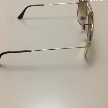 Rayban Gözlükte Pas Ve Kabarma Nedeniyle Sağlık Sorunu Yaşadım