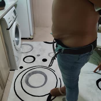 Ameliyat Sonrası Memnuniyetsizlik Ve Ek Ücret Talebi