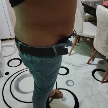 Ameliyat Sonrası Memnuniyetsizlik Ve Ek Ücret Talebi