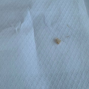 Hamburgerde Kıl Ve İlgisiz Personel Deneyimi