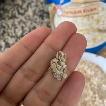 Aldığım Üründe Karşılaştığım Hijyen Sorunu Güvenimi Sarsıyor