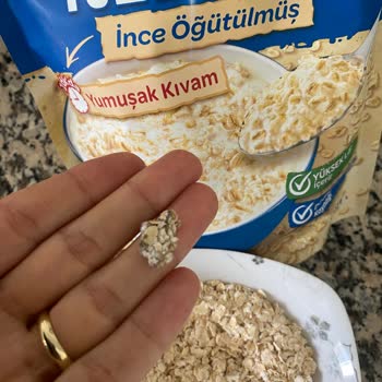 Aldığım Üründe Karşılaştığım Hijyen Sorunu Güvenimi Sarsıyor