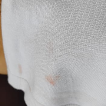 Poşet Boyası Kıyafetime Bulaştı, Mağduriyetim Giderilmedi