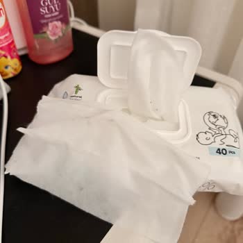 Sleepy Islak Mendillerde Küf Ve Kötü Koku: Bebek Sağlığı Tehlikede