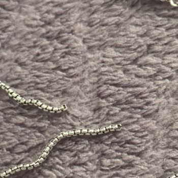 Pandora Bileklik Garanti Kapsamı Dışında Kaldı, Hayal Kırıklığı Yaşadım