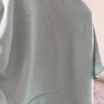 Aldığım Şortta Birden Fazla Delik Çıktı, Mağaza Kalitesine Yakışmadı