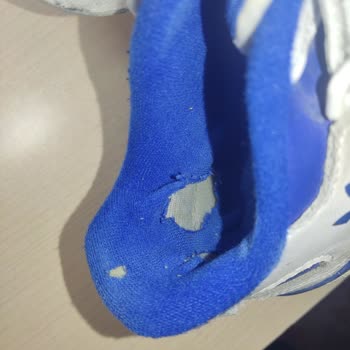 Kızımın Biriktirdiği Parayla Aldığı Adidas Ayakkabı Kısa Sürede Yırtıldı Garanti Verilmedi