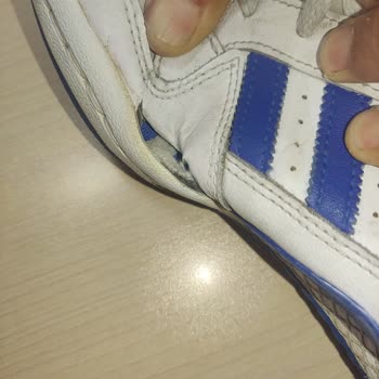 Kızımın Biriktirdiği Parayla Aldığı Adidas Ayakkabı Kısa Sürede Yırtıldı Garanti Verilmedi