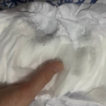 Bebek Bezinde Siyah Parçacık Şaşkınlığı Ve Hayal Kırıklığı