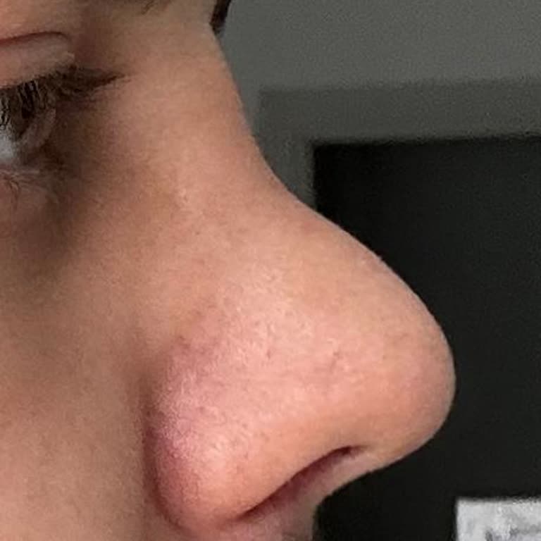 Sante Plus Hastanesi'nde Ameliyat Sonrası Büyük Hayal Kırıklığı