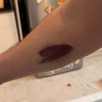 Medistate Kavacık Hastanesinde Damar Yolu Açma Ve İletişimde Ciddi Sorunlar Yaşadık