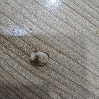 Fıstıklı Çikolatadan Çıkan Taş Dişimi Kırdı