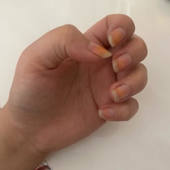 Eve Mağazasından Alınan Oje Tırnaklarımı Sararttı Ve Turuncuya Döndürdü
