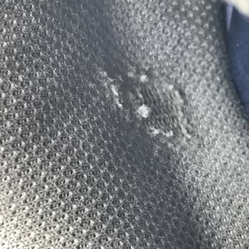 20 Günde Deforme Olan Ayakkabıya Skechers'tan Çözüm Yok