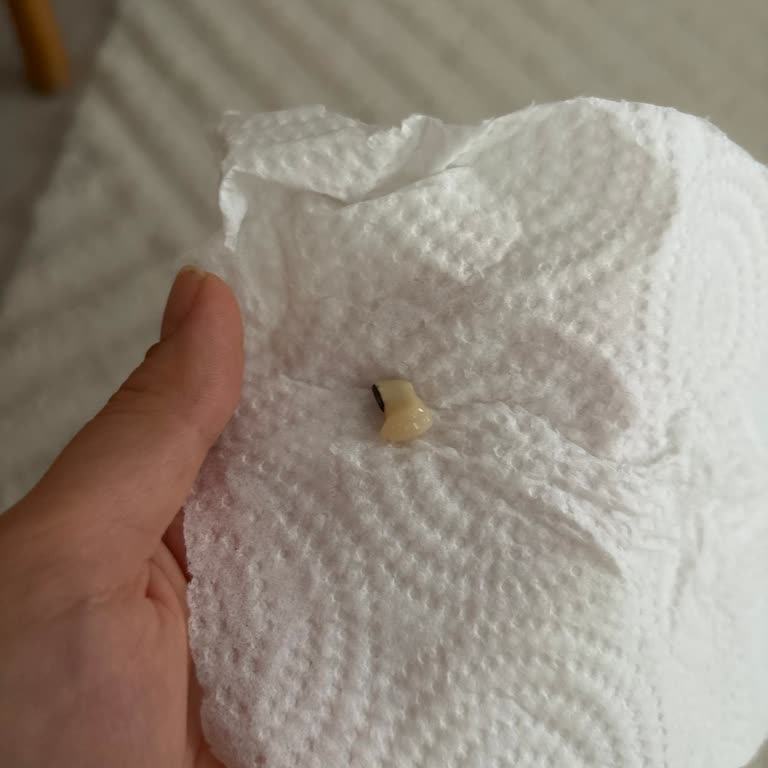 İmplant Sürekli Düşüyor, Kalıcı Çözüm Sunulmuyor