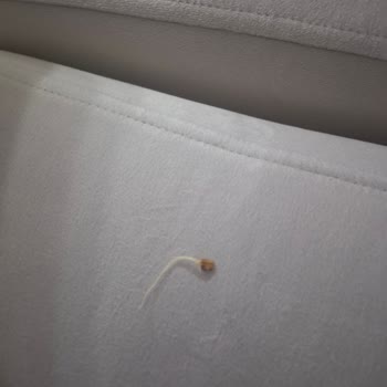 Cipso Cipsin İçinden Yabancı Madde Çıktı, Hayal Kırıklığına Uğradık