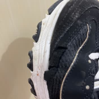 SuperStep Garanti Süresindeki Skechers Ayakkabımın Patlaması Ve Hatalı İnceleme