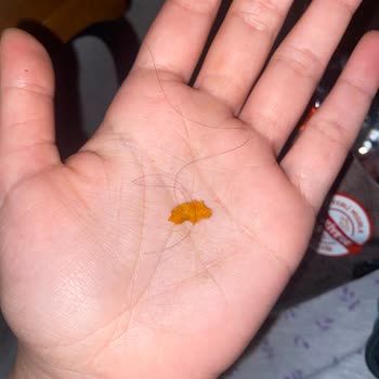 Cips Paketinden Uzun Saç Çıkması Ve Hijyen Sorunu