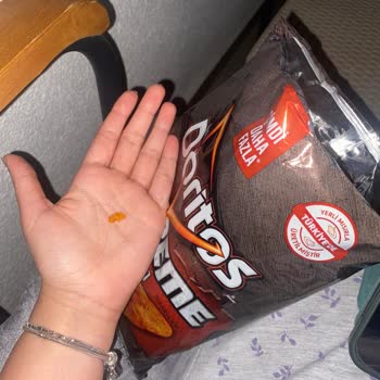 Cips Paketinden Uzun Saç Çıkması Ve Hijyen Sorunu