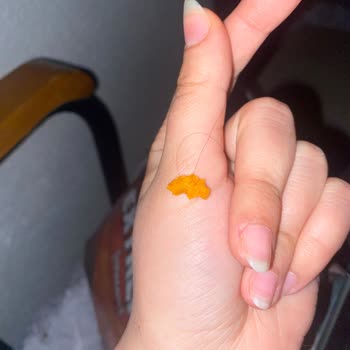 Cips Paketinden Uzun Saç Çıkması Ve Hijyen Sorunu