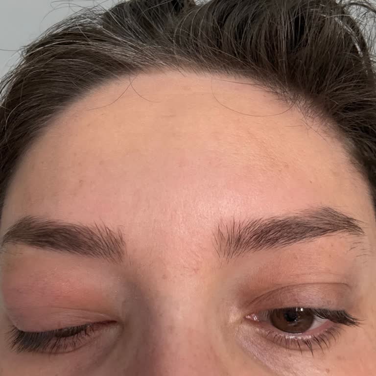 Botoks Sonrası Göz Kapağı Sorunum Giderilmedi, Doktor İlgisiz Kaldı