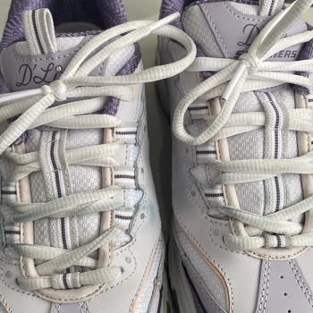 Skechers Ayakkabıda Renk Değişimi ve Olumsuz Müşteri Hizmeti