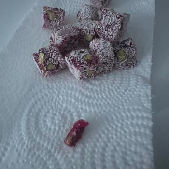 Lokumdan Çıkan Ağaç Parçası Dişimi Mahvetti, Kimse Dönmüyor!