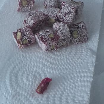 Lokumdan Çıkan Ağaç Parçası Dişimi Mahvetti, Kimse Dönmüyor!