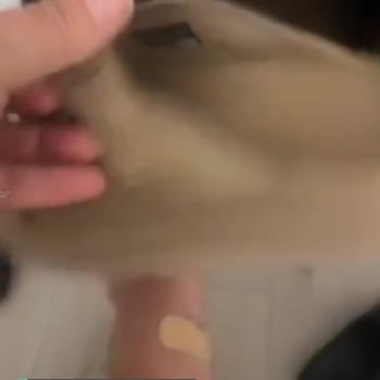 Ugg Terlik Ayağımı Vurdu Çok Rahatsız Edici!