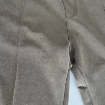 Eşofman Altındaki Tüylenme Sorunu Ve Yetersiz İnceleme Süreci Mağduriyeti